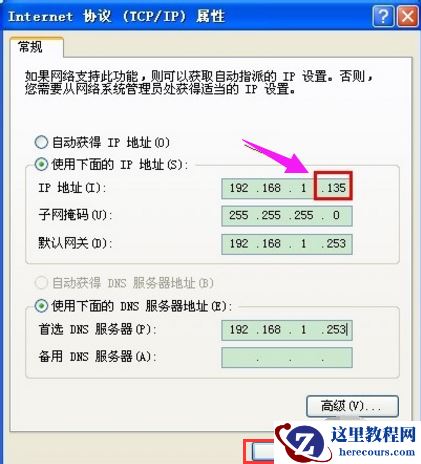 本地连接受限制,小编告诉你如何修复电脑接受限制