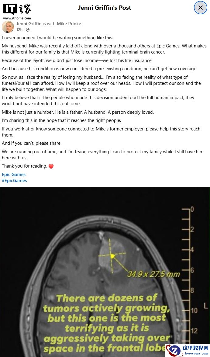 Epic 裁员超千人致患癌员工失去保险，家属发声求助